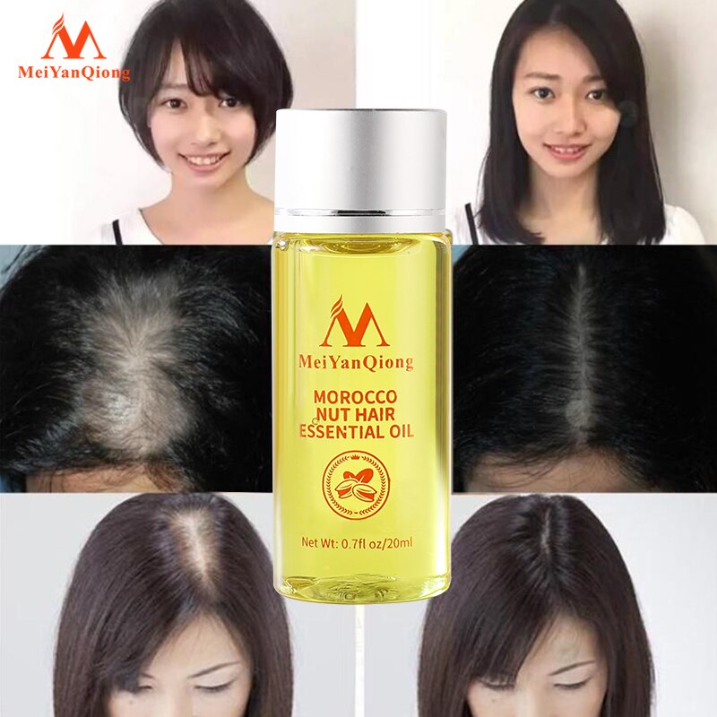 Morocco Hair Growth Nut Essential oil Prevent Hair Loss Remove oil Light Smooth  Hair Men And Women Repair Shampoo Hair Care 20ml - Shopizia
